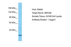 ZNF197 Rabbit anti-Human, Polyclonal, Novus Biologicals 0.1ml; Unconjugated:Antibodies,